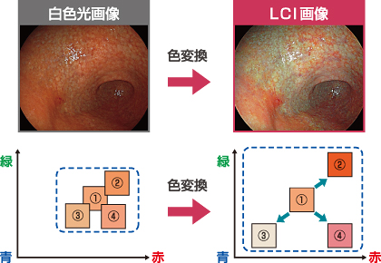 LCI画像