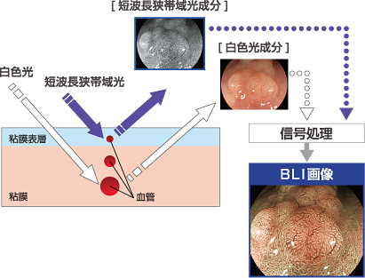 BLI画像