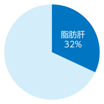 脂肪肝について